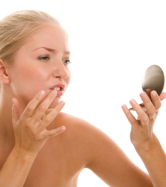 Fordyce Spots: Symptoms, Causes, Treatment & On Lips